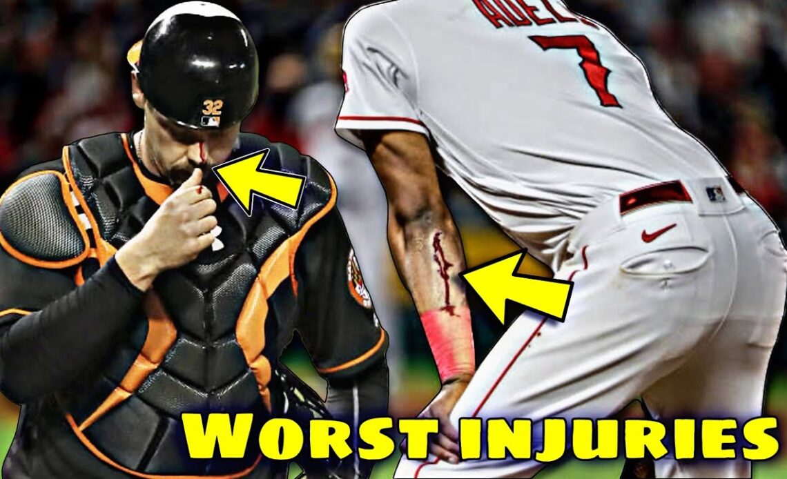 MLB | Unexpected Injuries